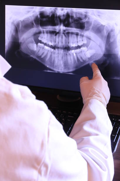 Best Emergency Broken Tooth Repair in Summerfield, MD